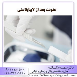 عفونت بعد از لابیاپلاستی