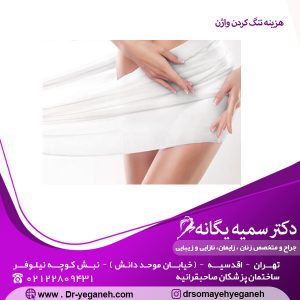 هزینه تنگ کردن واژن