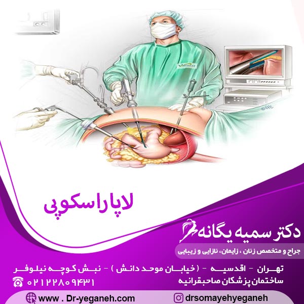 عکس لاپاراسکوپی _دکتر یگانه