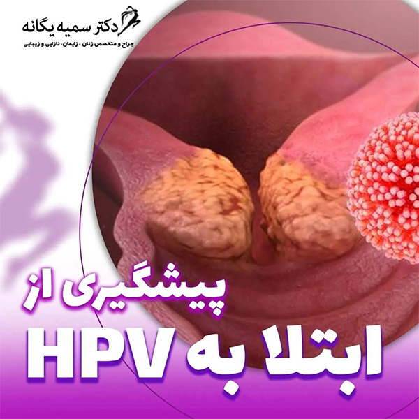 زگیل تناسلی - دکتر یگانه