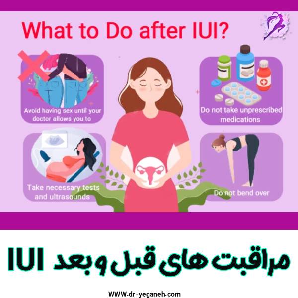 مراقبت های بعد قبل و بعد آی یو آی - دکتر سمیه یگانه