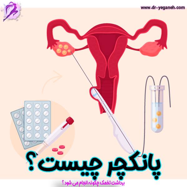 پانکچر چیست ؟ - دکتر سمیه یگانه