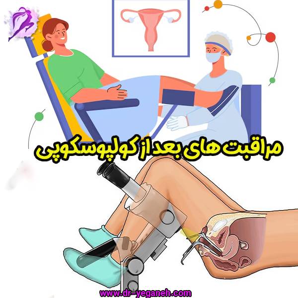 مراقبت های بعد از کولپوسکوپی - دکتر سمیه یگانه
