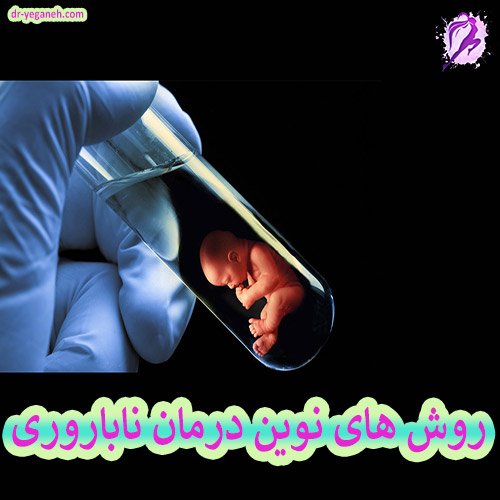 عکس روش درمان ناباروری - دکتر سمیه یگانه